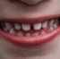 %d0%b7%d1%83%d0%b1%d1%8b1 - Udm-info.Ru